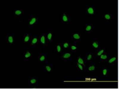 Immunocytochemistry/Immunofluorescence: ZHX1 Antibody [H00011244-B01P-50ug] -  Purified MaxPab antibody to ZHX1 on HeLa cell. [antibody concentration 10 ug/ml]