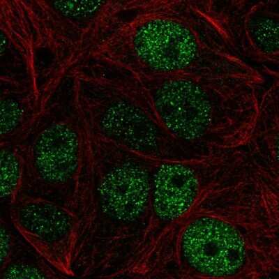 Immunocytochemistry/Immunofluorescence: ZHX1 Antibody [NBP2-55880] - Staining of human cell line MCF7 shows localization to nucleoplasm.
