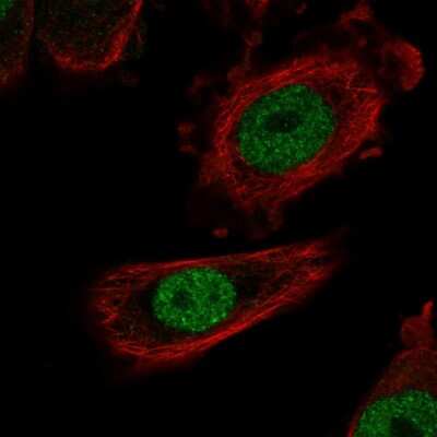 Immunocytochemistry/Immunofluorescence: ZHX1 Antibody [NBP2-56728] - Staining of human cell line PC-3 shows localization to nucleoplasm.