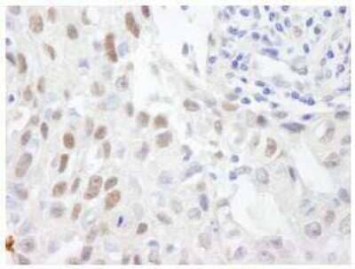 Immunohistochemistry-Paraffin ZHX3 Antibody