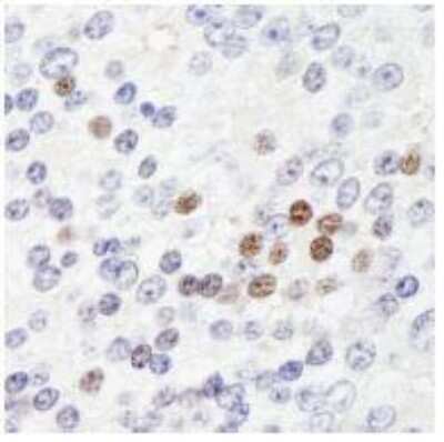 Immunohistochemistry-Paraffin ZHX3 Antibody