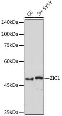 Western Blot: ZIC1 Antibody (6B5O9) [NBP3-15774] - Western blot analysis of extracts of various cell lines, using ZIC1 Rabbit mAb (NBP3-15774) at 1:1000 dilution. Secondary antibody: HRP Goat Anti-Rabbit IgG (H+L) at 1:10000 dilution. Lysates/proteins: 25ug per lane. Blocking buffer: 3% nonfat dry milk in TBST. Detection: ECL Basic Kit. Exposure time: 180s.