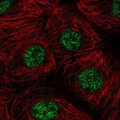 Immunocytochemistry/Immunofluorescence: ZIC1 Antibody [NBP1-86833] - Staining of human cell line MCF7 shows localization to nucleoplasm. Antibody staining is shown in green.