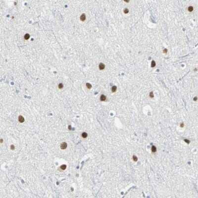 Immunohistochemistry-Paraffin: ZIC1 Antibody [NBP1-86833] - Staining of human cerebral cortex shows strong nuclear positivity in neurons.