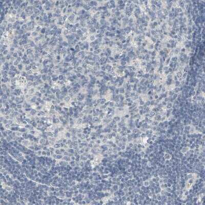 Immunohistochemistry-Paraffin: ZIC1 Antibody [NBP1-86833] - Staining of human lymph node shows no positivity in germinal center cells as expected.