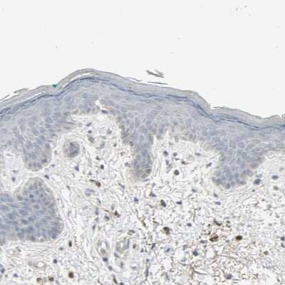 Immunohistochemistry-Paraffin: ZIC1 Antibody [NBP1-86833] - Staining of human skin shows no positivity in squamous epithelial cells as expected.