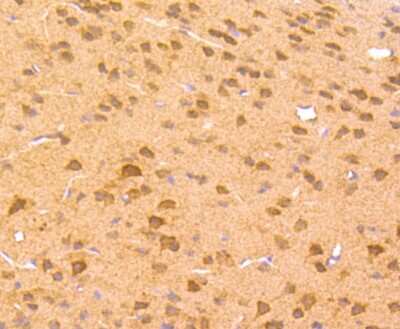 Immunohistochemistry-Paraffin: ZIC1 Antibody (JA31-60) [NBP2-66791] - Analysis of paraffin-embedded mouse brain tissue using anti-Zic1 antibody. Counter stained with hematoxylin.