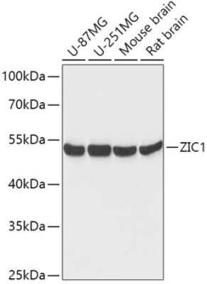 Western Blot: ZIC1 Antibody [NBP2-94229] - Analysis of extracts of various cell lines, using ZIC1 at 1:1000 dilution. Secondary antibody: HRP Goat Anti-Rabbit IgG (H+L) at 1:10000 dilution. Lysates/proteins: 25ug per lane. Blocking buffer: 3% nonfat dry milk in TBST. Detection: ECL Basic Kit . Exposure time: 30s.