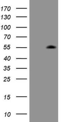 Western Blot: ZIC3 Antibody (1G7) [NBP2-46414] - Analysis of HEK293T cells were transfected with the pCMV6-ENTRY control (Left lane) or pCMV6-ENTRY ZIC3.