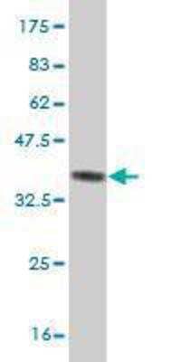 Western Blot: ZIC3 Antibody (2D3) [H00007547-M02] - detection against Immunogen (36.23 KDa) .