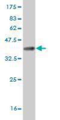 Western Blot: ZIC3 Antibody (4G6) [H00007547-M04] - detection against Immunogen (36.23 KDa) .