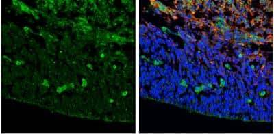 Immunohistochemistry-Frozen: ZIC3 Antibody [NBP1-33207] - Frozen sectioned E13.5 Rat brain.  Green: ZIC3 protein stained by ZIC3 antibody [N3C3] diluted at 1:250. Red: beta Tubulin 3/ TUJ1, a mature neuron marker, stained by beta Tubulin 3/ TUJ1 antibody [11710]  diluted at 1:500. Blue: Fluoroshield with DAPI. 