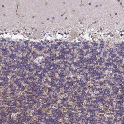 Immunohistochemistry: ZIC3 Antibody [NBP2-33669] - Immunohistochemical staining of human cerebellum shows moderate cytoplasmic positivity in cells in granular layer.