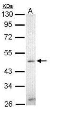 Western Blot: ZIC3 Antibody [NBP1-33207] - Sample (30 ug of whole cell lysate) A: Hep G2  10% SDS PAGE; antibody diluted at 1:500