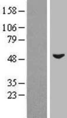 Western Blot: ZIC3 Overexpression Lysate (Adult Normal) [NBP2-08013] Left-Empty vector transfected control cell lysate (HEK293 cell lysate); Right -Over-expression Lysate for ZIC3.