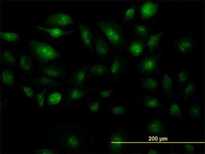 Immunocytochemistry/Immunofluorescence: ZIC4 Antibody (2C2) [H00084107-M07] - Analysis of monoclonal antibody to ZIC4 on HeLa cell. Antibody concentration 30 ug/ml