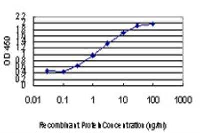 ELISA: ZIC4 Antibody (3D5) [H00084107-M06] - Detection limit for recombinant GST tagged ZIC4 is approximately 0.3ng/ml as a capture antibody.