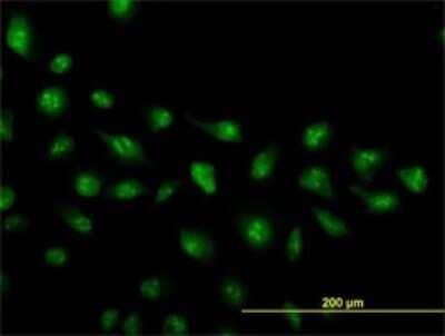 Immunocytochemistry/Immunofluorescence: ZIC4 Antibody (4B1) [H00084107-M01] - Analysis of monoclonal antibody to ZIC4 on HeLa cell. Antibody concentration 25 ug/ml.