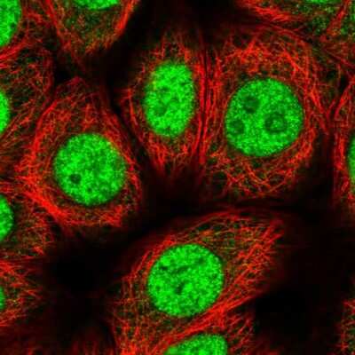 Immunocytochemistry/Immunofluorescence: ZIC4 Antibody [NBP2-37867] - Immunofluorescent staining of human cell line MCF7 shows localization to nucleus & nucleoli.