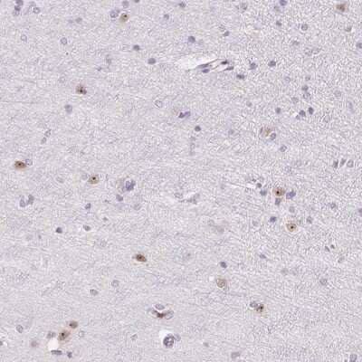 Immunohistochemistry-Paraffin: ZIC4 Antibody [NBP2-37867] - Staining of human cerebral cortex shows nucleolar positivity in neuronal cells.