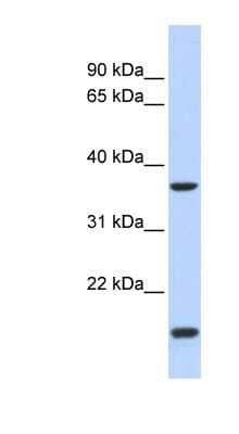 Western Blot: ZIC4 Antibody [NBP1-80375] - Human Heart lysate, concentration 0.2-1 ug/ml.