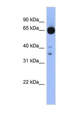 Western Blot: ZIC4 Antibody [NBP1-80376] - Human Stomach, concentration 0.2-1 ug/ml.