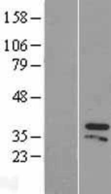 Western Blot: ZIC4 Overexpression Lysate (Adult Normal) [NBP2-06067] Left-Empty vector transfected control cell lysate (HEK293 cell lysate); Right -Over-expression Lysate for ZIC4.