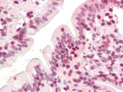 Immunohistochemistry-Paraffin: ZIC5 Antibody [NBP1-50469] - Analysis of anti-ZIC5 antibody with human skin at concentration 3.75 ug/ml.