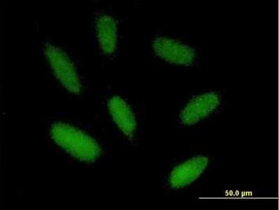 Immunocytochemistry/Immunofluorescence: ZIM2 Antibody [H00023619-B01P] - Analysis of purified antibody to ZIM2 on HepG2 cell. (antibody concentration 20 ug/ml)