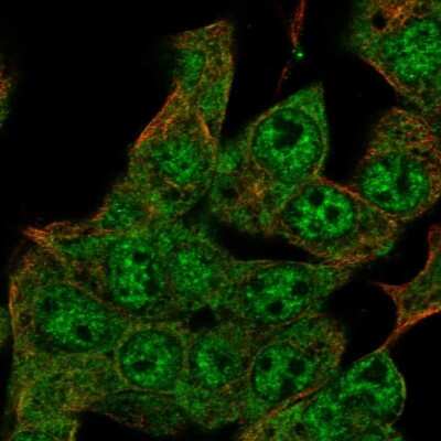 Immunocytochemistry/Immunofluorescence: ZIM2 Antibody [NBP2-57865] - Staining of human cell line Hep G2 shows localization to nuclear speckles & cytosol.