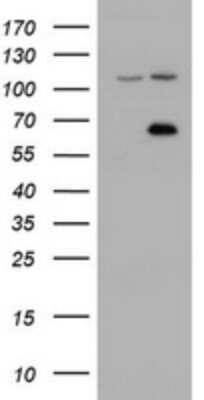 Western Blot: ZIM2 Antibody (OTI6D12) - Azide and BSA Free [NBP2-74928] - Analysis of HEK293T cells were transfected with the pCMV6-ENTRY control (Left lane) or pCMV6-ENTRY ZIM2 .