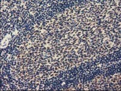 Immunohistochemistry: ZIM2 Antibody (OTI7G1) - Azide and BSA Free [NBP2-74929] - Staining of paraffin-embedded Human lymph node tissue within the normal limits using anti-ZIM2 mouse monoclonal antibody.