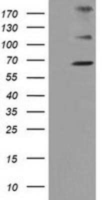 Western Blot: ZIM2 Antibody (OTI7G1) - Azide and BSA Free [NBP2-74929] - HEK293T cells were transfected with the pCMV6-ENTRY control (Left lane) or pCMV6-ENTRY ZIM2 (Right lane) cDNA for 48 hrs and lysed. Equivalent amounts of cell lysates (5 ug per lane) were separated by SDS-PAGE and immunoblotted with anti-ZIM2.