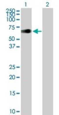 Western Blot ZIM2 Antibody