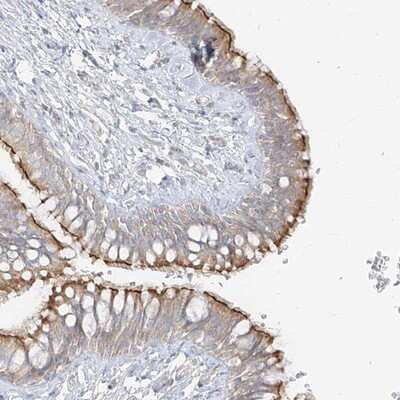 Immunohistochemistry-Paraffin ZIM3 Antibody - BSA Free