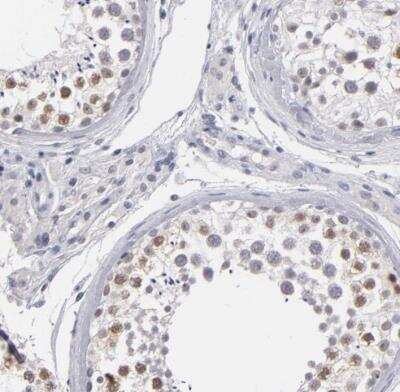 Immunohistochemistry-Paraffin: ZIP4H/Tex11 Antibody [NBP1-80692] - Staining of human testis shows moderate nuclear positivity in cells in seminiferous ducts.