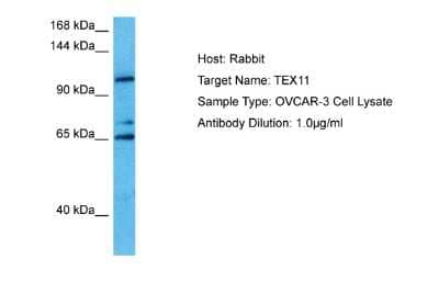 Western Blot: ZIP4H/Tex11 Antibody [NBP2-88635] - Host: Rabbit. Target Name: TEX11. Sample Tissue: Human OVCAR-3 Whole Cell lysates. Antibody Dilution: 1ug/ml