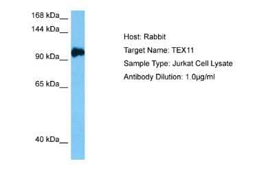 Western Blot: ZIP4H/Tex11 Antibody [NBP2-88636] - Host: Rabbit. Target Name: TEX11. Sample Tissue: Human Jurkat Whole Cell lysates. Antibody Dilution: 1ug/ml