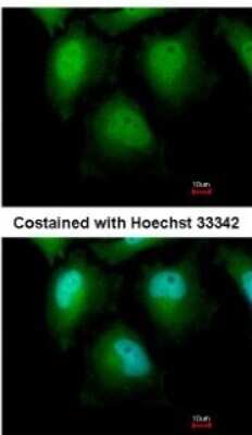 Immunocytochemistry/Immunofluorescence: ZKSCAN1 Antibody [NBP2-20958] - Analysis of paraformaldehyde-fixed HeLa, using antibody at 1:500 dilution.