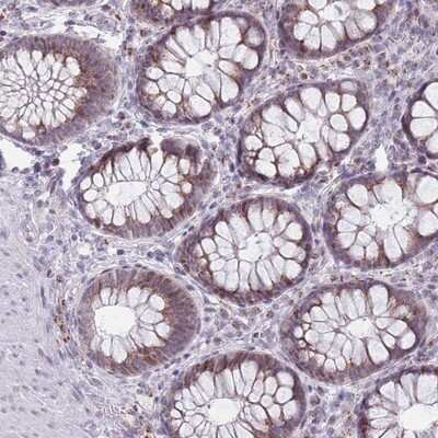 Immunohistochemistry-Paraffin: ZKSCAN2 Antibody [NBP2-13549] - Staining of human rectum shows moderate cytoplasmic and nuclear positivity in glandular cells.