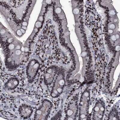 Immunohistochemistry-Paraffin: ZMIZ2 Antibody [NBP1-85032] - Staining of human duodenum shows strong nuclear positivity in glandular cells.