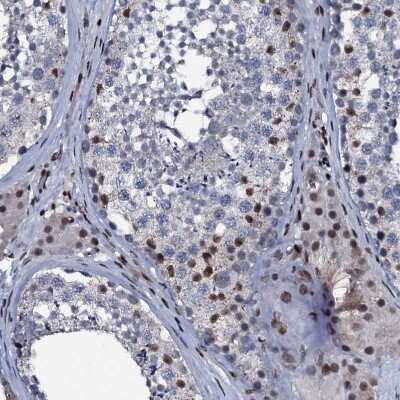 Immunohistochemistry-Paraffin: ZMIZ2 Antibody [NBP1-85032] - Staining of human testis shows strong nuclear positivity in Leydig cells and cells in seminiferous ducts.