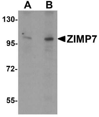 Western Blot ZMIZ2 Antibody - BSA Free