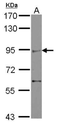 Western Blot: ZMIZ2 Antibody [NBP2-20959] - Sample (30 ug of whole cell lysate) A: IMR32 7. 5% SDS PAGE gel, diluted at 1:500.