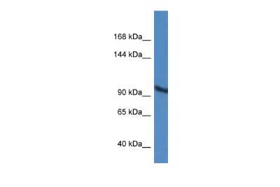 Western Blot: ZMIZ2 Antibody [NBP2-88639] - WB Suggested Anti-ZMIZ2 Antibody. Titration: 1.0 ug/ml. Positive Control: A549 Whole Cell