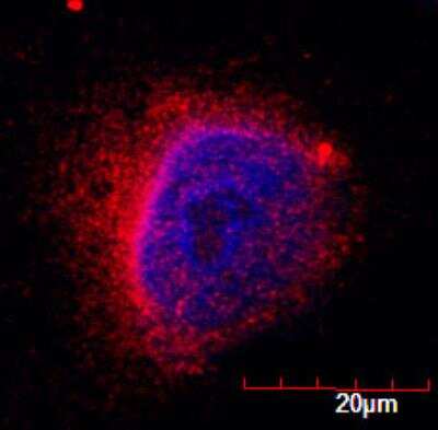 Immunocytochemistry/Immunofluorescence: ZMPSTE24 Antibody [NB100-2387] - Analysis of ZMPSTE24 in A549 cells using anti-ZMPSTE24 antibody. Image from verified customer review.