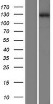 Western Blot: ZMYM1 Overexpression Lysate (Adult Normal) [NBP2-06289] Left-Empty vector transfected control cell lysate (HEK293 cell lysate); Right -Over-expression Lysate for ZMYM1.