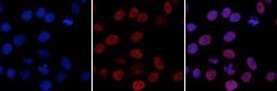 Immunocytochemistry/Immunofluorescence: ZMYM3 Antibody (C.15200016) [NBP2-59244] - HeLa cells were stained with the antibody against ZMYM3 and with DAPI. Cells were fixed with 4% formaldehyde for 10 minutes and blocked with PBS/Triton X-100 containing 1% BSA. The cells were immunofluorescently labeled with the ZMYM3 antibody (middle) diluted 1:1.000 in blocking solution followed by an anti-mouse antibody conjugated to Alexa Fluor 594. The left panel shows staining of the nuclei with DAPI. A merge of the two stainings is shown on the right.