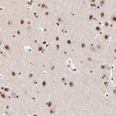 Immunohistochemistry-Paraffin: ZMYM3 Antibody [NBP1-84952] - Staining of human hippocampus shows strong nuclear positivity in neuronal cells.