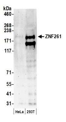 Western Blot: ZMYM3 Antibody [NB100-458] - Whole cell lysate (50 ug) from HeLa and 293T cells prepared using NETN lysis buffer. Antibody: Affinity purified rabbit anti-ZNF261 antibody NB100-458 used for WB at 0.04 ug/ml. Detection: Chemiluminescence with an exposure time of 3 minutes.